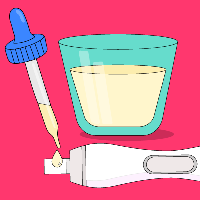 Recueillir l’urine dans un pot et utiliser une pipette pour déposer l’urine sur la bandelette de test.